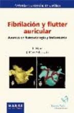 Fibrilación y Flutter Auricular