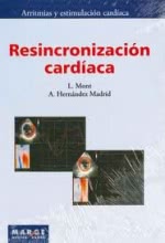Resincronización Cardíaca