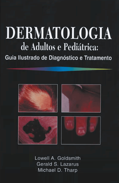 Dermatologia de Adultos e Pediátrica: Guia Ilustrado de Diagnóstico e Tratamento