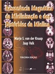 Ressonância Magnética da Mielinização e dos Distúrbios da Mielina