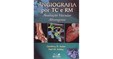 Angiografia por TC e RM - Avaliação Vascular Abrangente