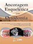 Ancoragem Esquelética em Ortodontia