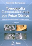 Tomografia Computadorizada por Feixe Cônico - Interpretação e Diagnóstico para o Cirurgião-Dentista