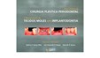 Atlas Clínico de Cirurgia Plástica Periodontal