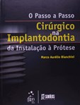 O Passo-a-Passo Cirúrgico na Implantodontia - Da Instalação à Prótese