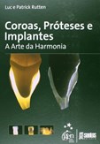 Coroas, Próteses e Implantes - A Arte da Harmonia