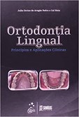 Ortodontia Lingual - Princípios e Aplicações Clínicas