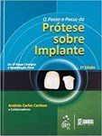 O Passo-a-Passo da Prótese Sobre Implantes - Da 2ª Etapa Cirúrgica à Reabilitação Final