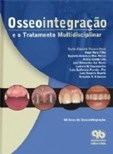 Osseointegração e o Tratamento Multidisciplinar