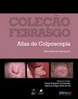 Atlas de Colposcopia