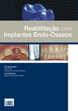 Reabilitação com Implantes Endo-Ósseos