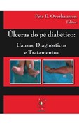 Úlceras do Pé Diabético - Causas, Diagnósticos e Tratamentos