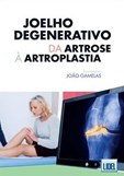 Joelho Degenerativo: da artrose à artroplastia