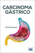 Carcinoma Gástrico